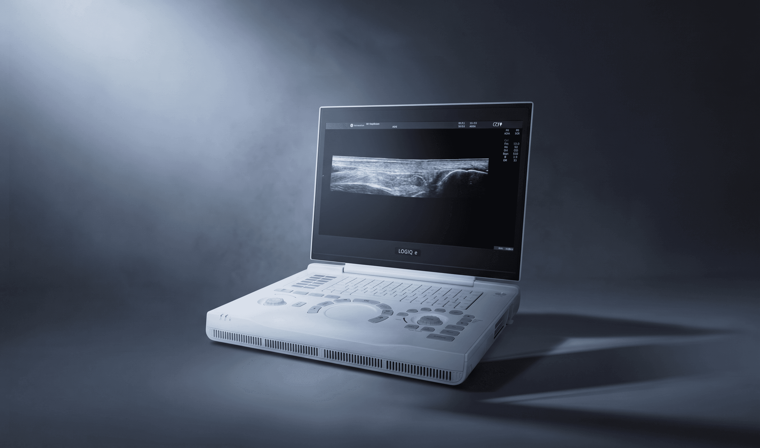 ECOGRAFO PORTATIL LOGIQ E R9